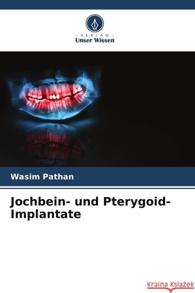 Jochbein- und Pterygoid-Implantate Pathan, Wasim 9786205164815