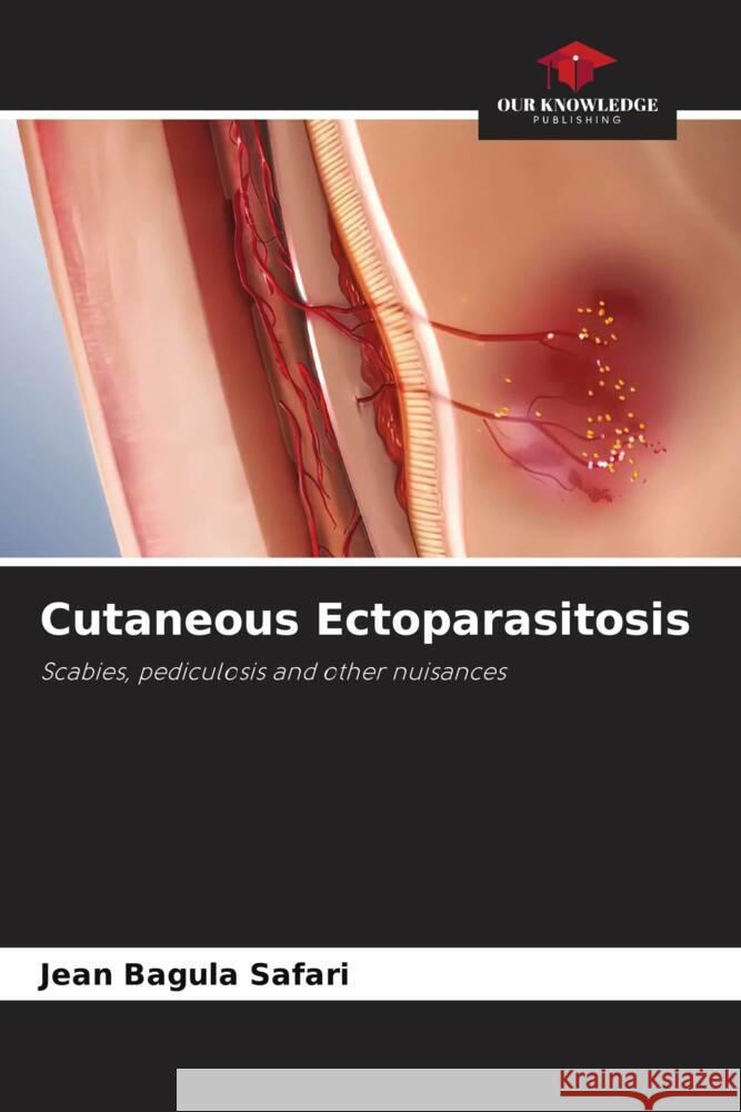 Cutaneous Ectoparasitosis Bagula Safari, Jean 9786205173527