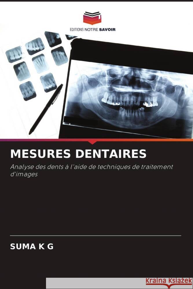 MESURES DENTAIRES K G, Suma 9786205180433 Editions Notre Savoir