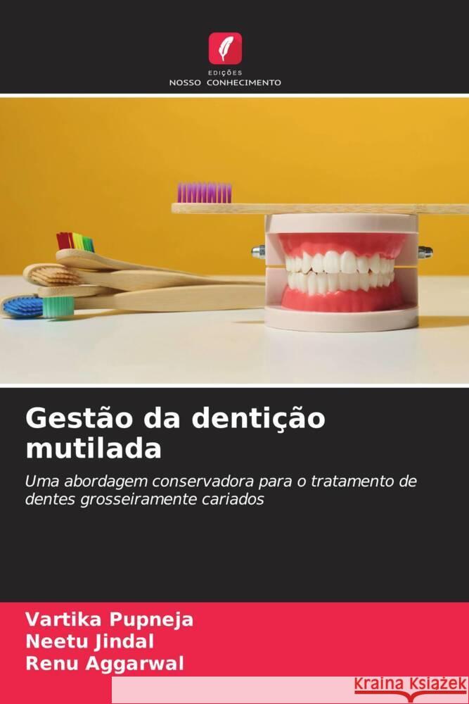 Gestão da dentição mutilada Pupneja, Vartika, Jindal, Neetu, Aggarwal, Renu 9786205180594