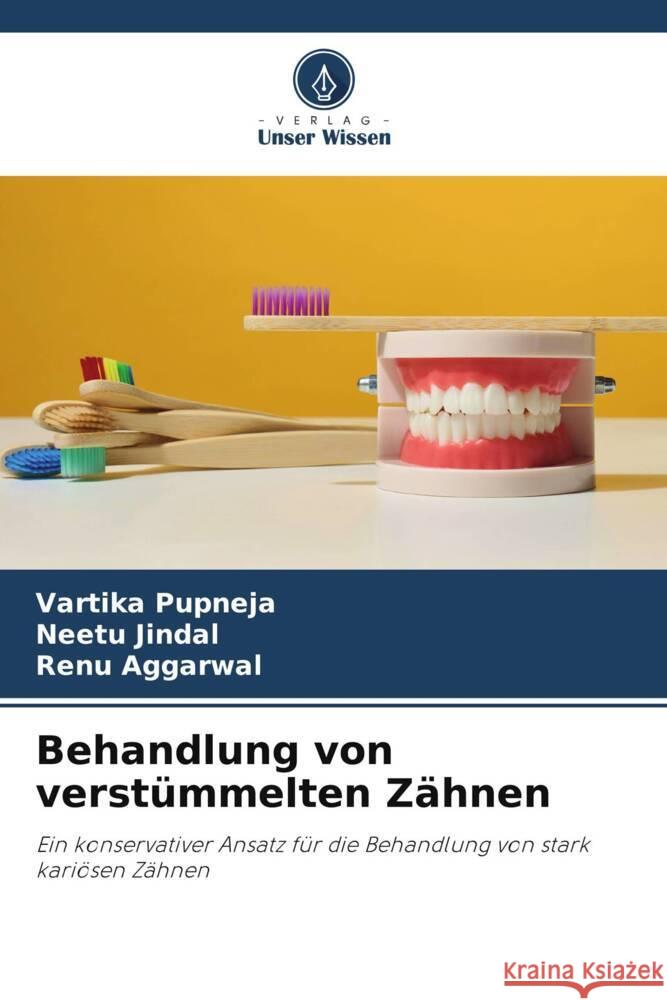 Behandlung von verstümmelten Zähnen Pupneja, Vartika, Jindal, Neetu, Aggarwal, Renu 9786205180600 Verlag Unser Wissen