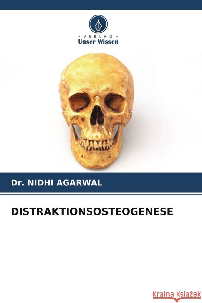 DISTRAKTIONSOSTEOGENESE AGARWAL, Dr. NIDHI 9786205184301