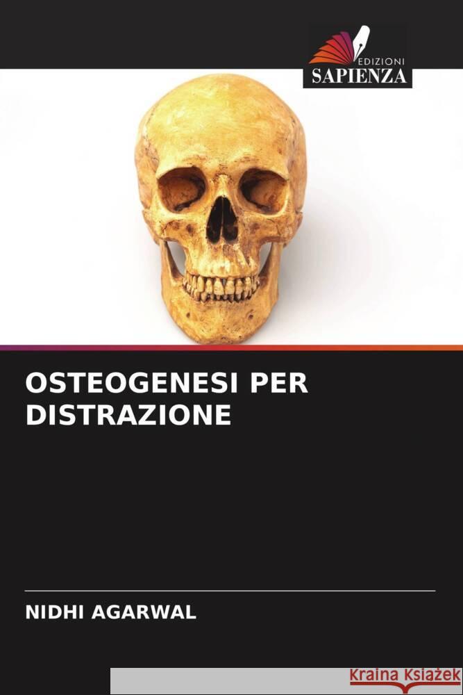 OSTEOGENESI PER DISTRAZIONE Agarwal, Nidhi 9786205184493 Edizioni Sapienza