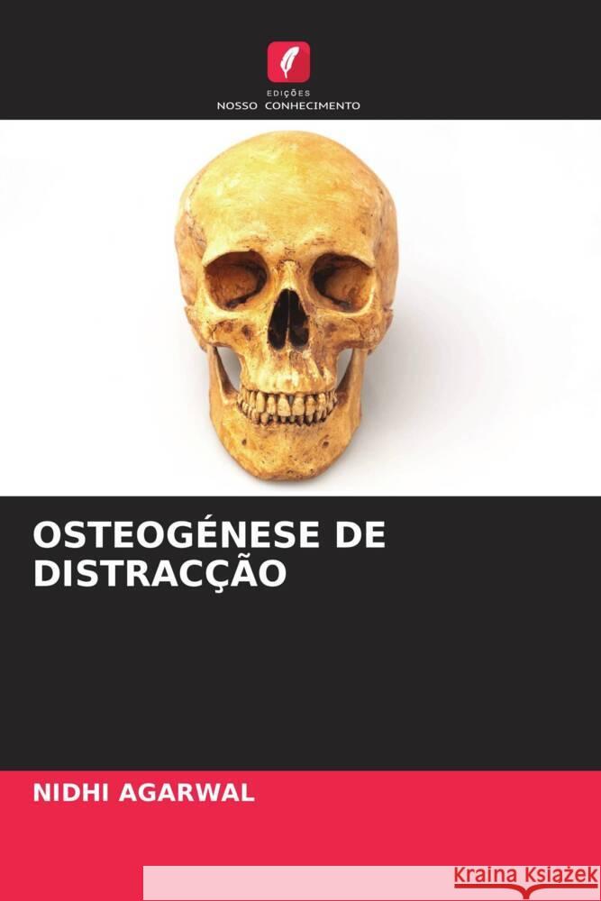 OSTEOGÉNESE DE DISTRACÇÃO Agarwal, Nidhi 9786205184509 Edições Nosso Conhecimento