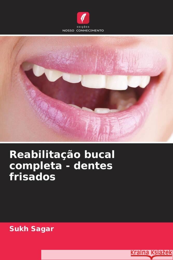 Reabilitação bucal completa - dentes frisados Sagar, Sukh 9786205201497