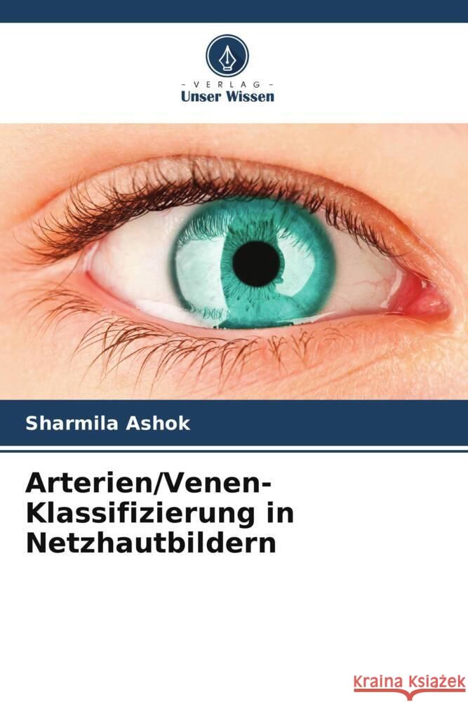 Arterien/Venen-Klassifizierung in Netzhautbildern Ashok, Sharmila 9786205205938