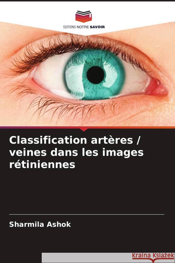 Classification artères / veines dans les images rétiniennes Ashok, Sharmila 9786205205952