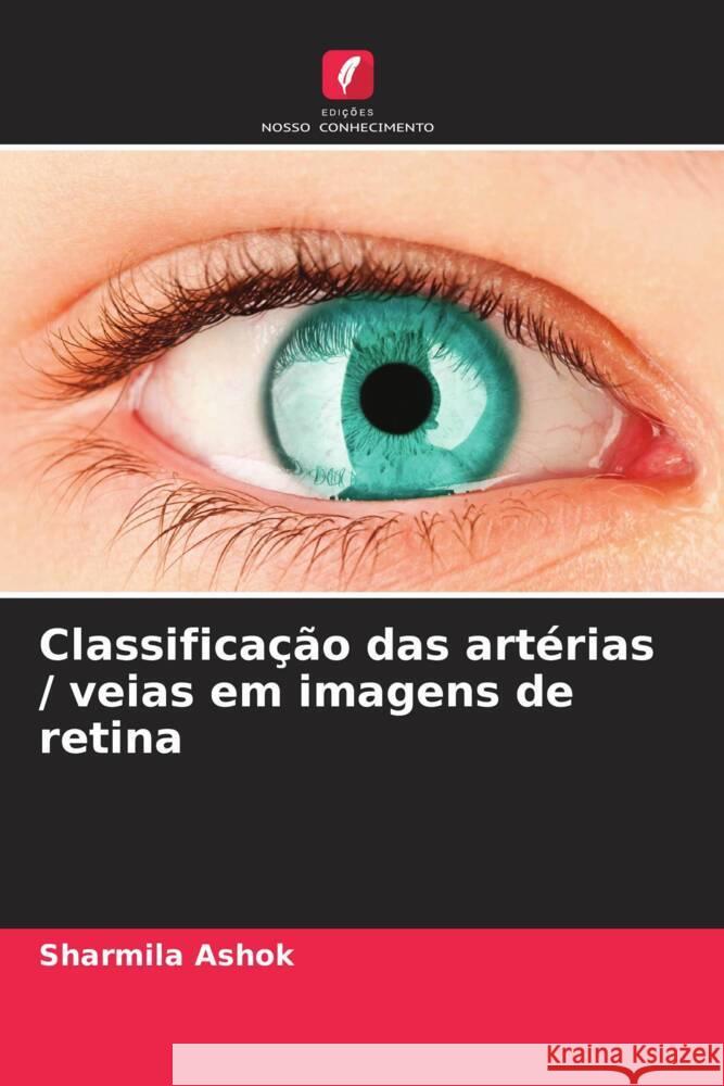 Classificação das artérias / veias em imagens de retina Ashok, Sharmila 9786205205976