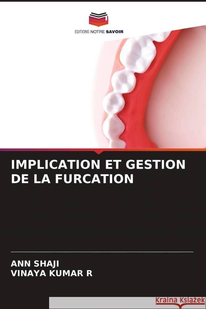 IMPLICATION ET GESTION DE LA FURCATION Shaji, Ann, KUMAR R, VINAYA 9786205207949