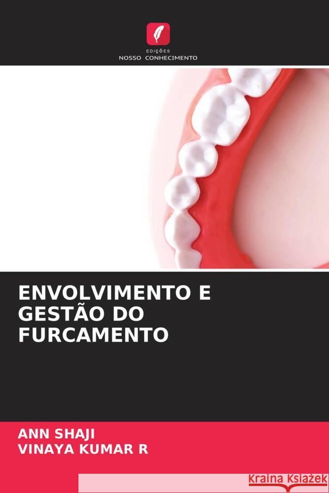 ENVOLVIMENTO E GESTÃO DO FURCAMENTO Shaji, Ann, KUMAR R, VINAYA 9786205207963