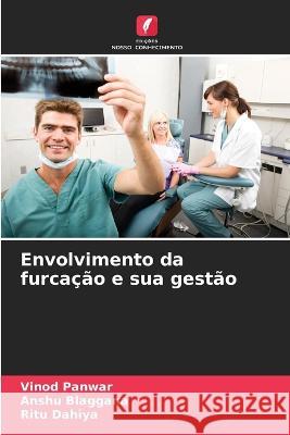 Envolvimento da furcação e sua gestão Panwar, Vinod 9786205229170