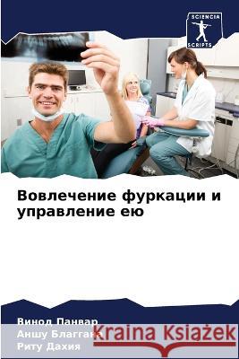 Вовлечение фуркации и уп Панваl 9786205229187 Sciencia Scripts