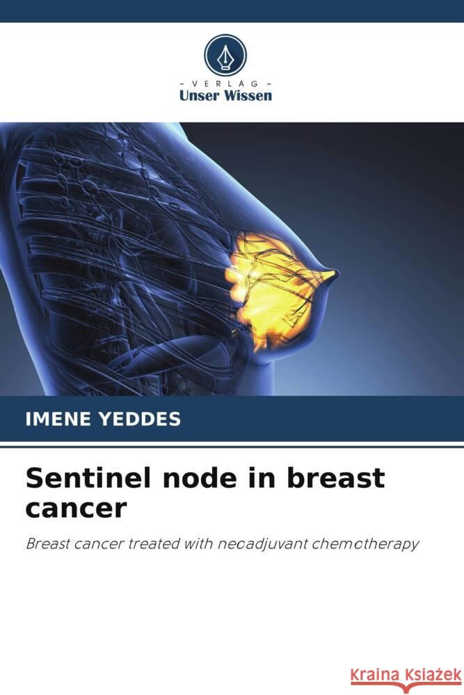 Sentinel node in breast cancer Yeddes, Imene 9786205233849 Verlag Unser Wissen