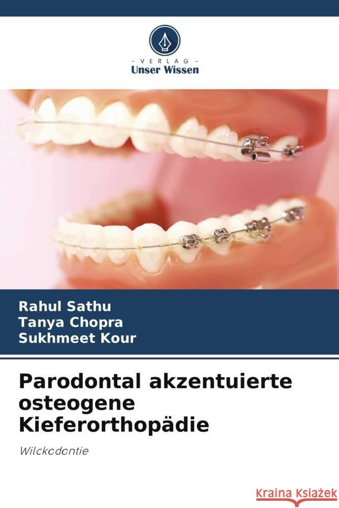 Parodontal akzentuierte osteogene Kieferorthopädie Sathu, Rahul, Chopra, Tanya, Kour, Sukhmeet 9786205245842 Verlag Unser Wissen