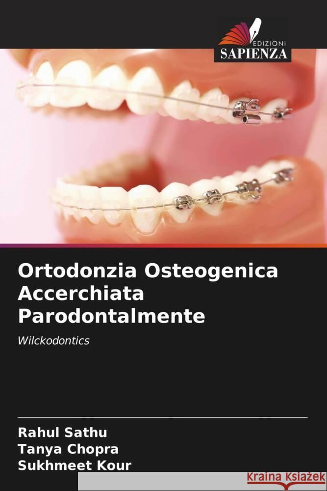 Ortodonzia Osteogenica Accerchiata Parodontalmente Sathu, Rahul, Chopra, Tanya, Kour, Sukhmeet 9786205245873 Edizioni Sapienza