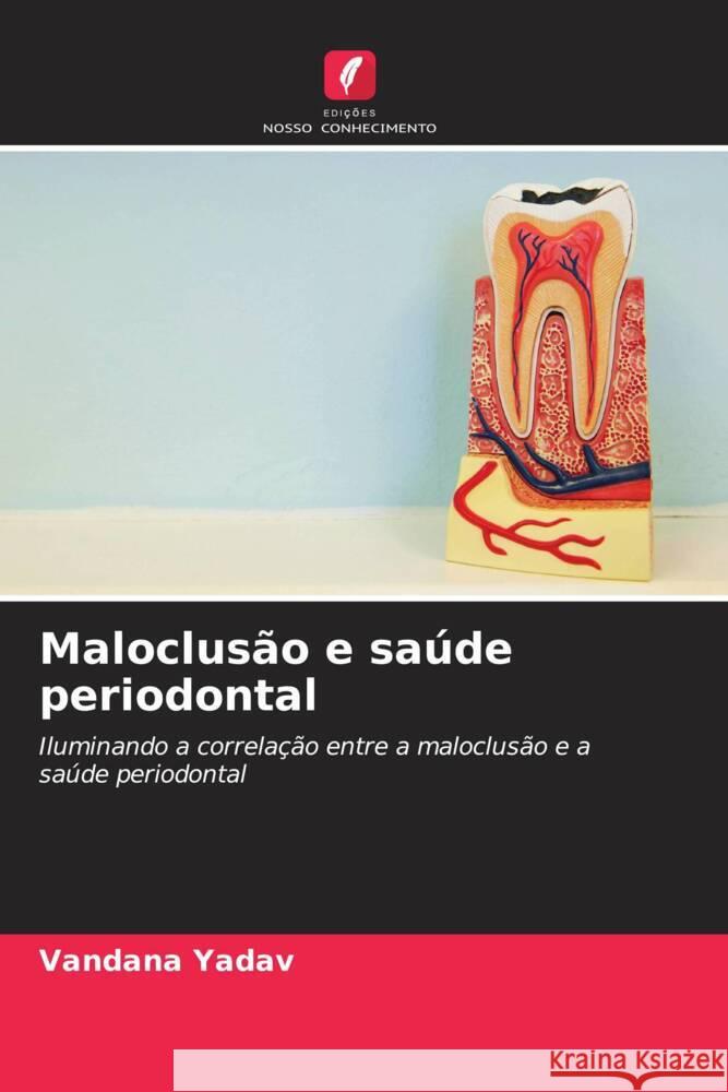 Maloclusão e saúde periodontal Yadav, Vandana 9786205253120