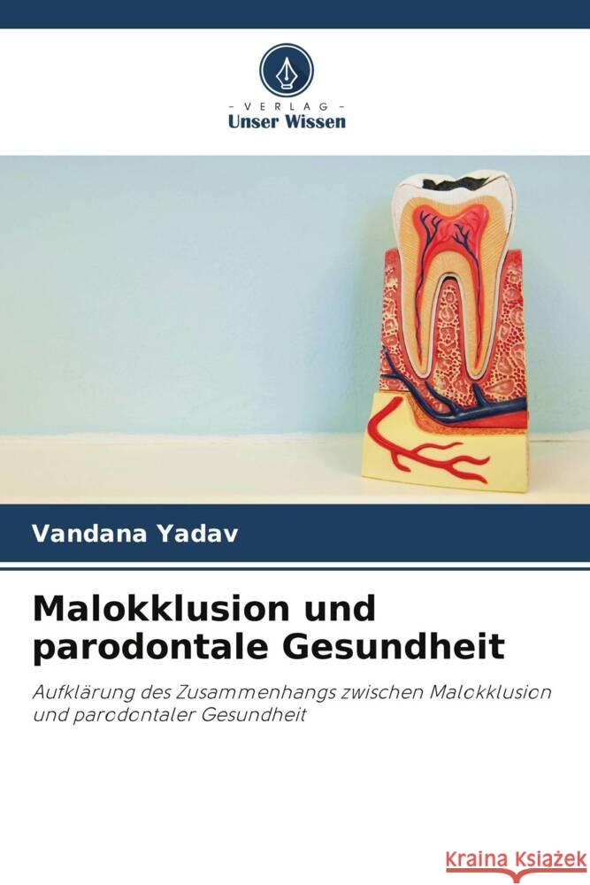 Malokklusion und parodontale Gesundheit Yadav, Vandana 9786205253137