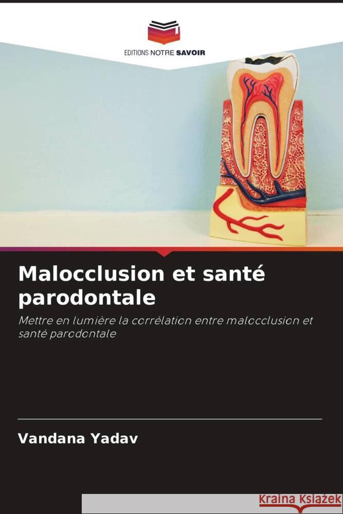 Malocclusion et santé parodontale Yadav, Vandana 9786205253151