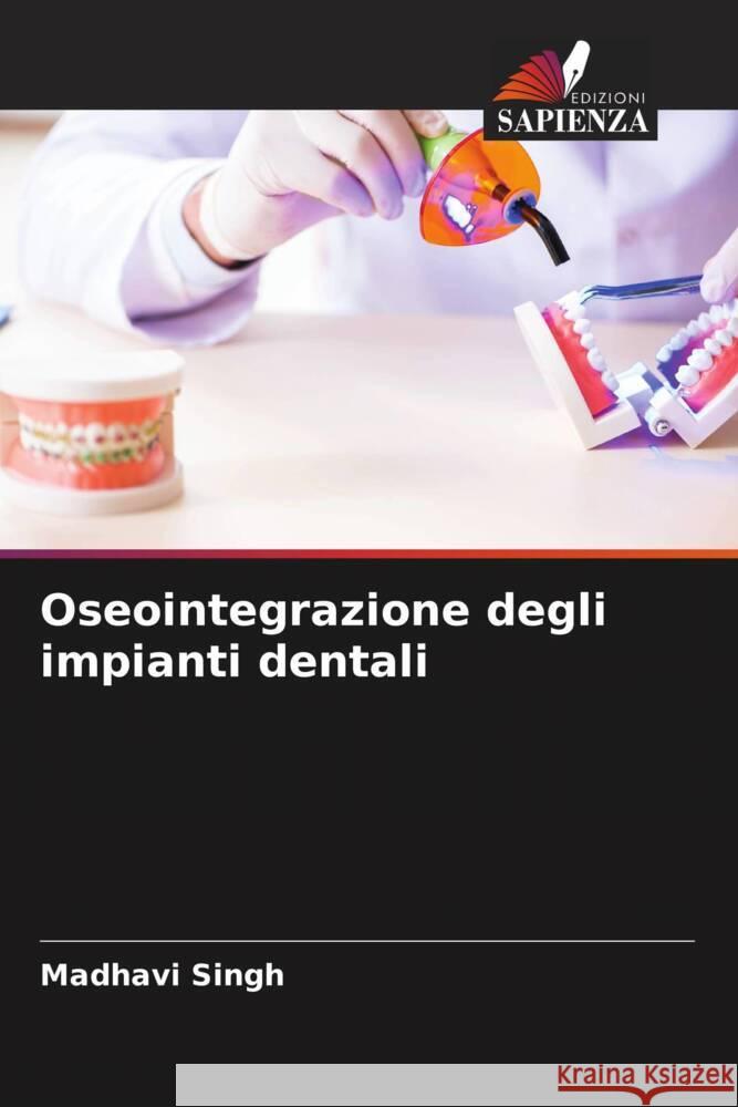 Oseointegrazione degli impianti dentali Singh, Madhavi 9786205253519