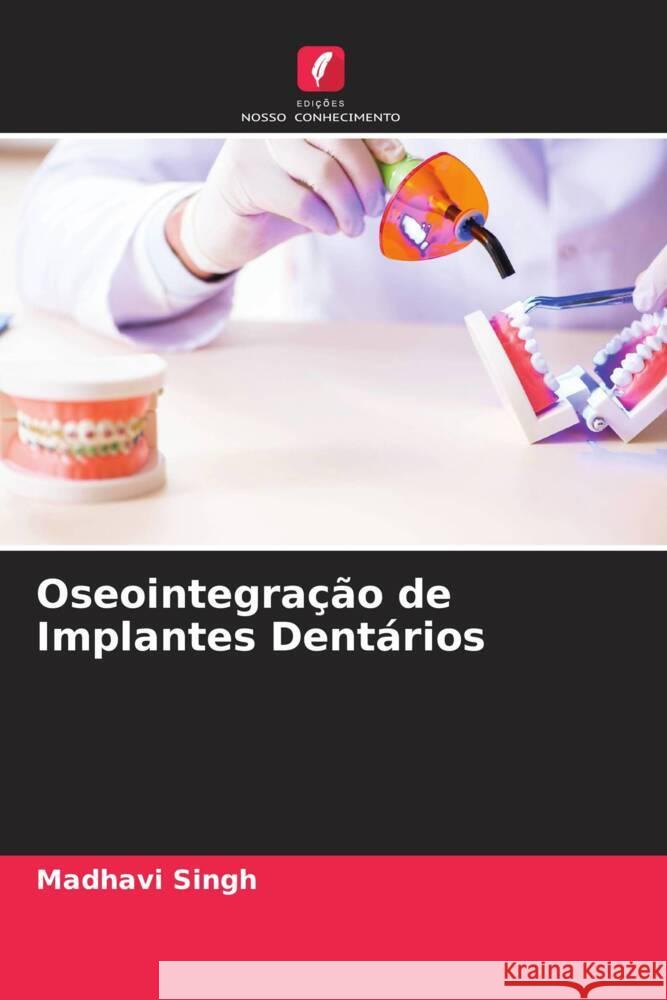 Oseointegração de Implantes Dentários Singh, Madhavi 9786205253526