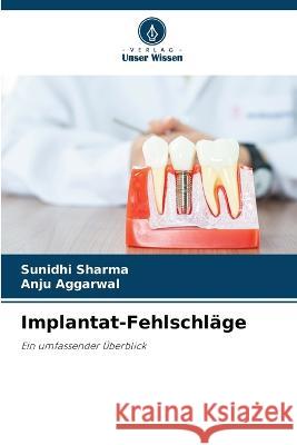 Implantat-Fehlschläge Sunidhi Sharma, Anju Aggarwal 9786205262337