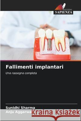 Fallimenti implantari Sunidhi Sharma, Anju Aggarwal 9786205262368 Edizioni Sapienza