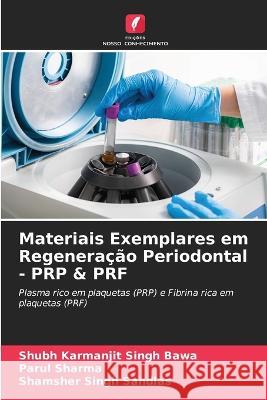 Materiais Exemplares em Regeneração Periodontal - PRP & PRF Shubh Karmanjit Singh Bawa, Parul Sharma, Shamsher Singh Sandlas 9786205265482 Edicoes Nosso Conhecimento