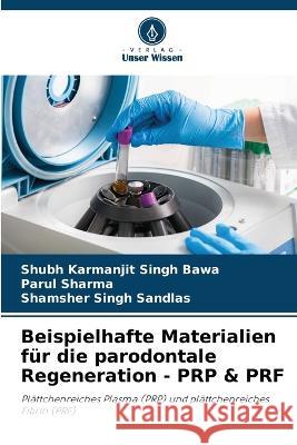 Beispielhafte Materialien für die parodontale Regeneration - PRP & PRF Shubh Karmanjit Singh Bawa, Parul Sharma, Shamsher Singh Sandlas 9786205265536 Verlag Unser Wissen