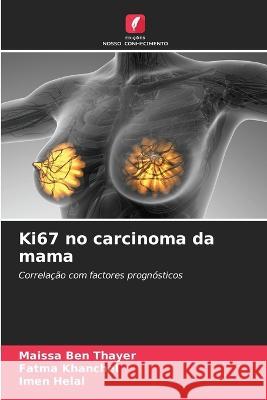 Ki67 no carcinoma da mama Maissa Ben Thayer, Fatma Khanchel, Imen Helal 9786205266571