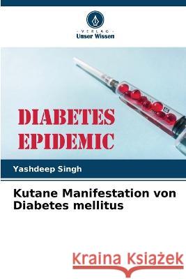 Kutane Manifestation von Diabetes mellitus Yashdeep Singh 9786205267479