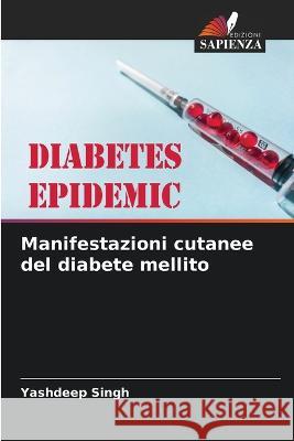 Manifestazioni cutanee del diabete mellito Yashdeep Singh 9786205267509