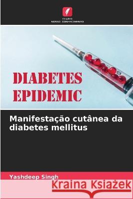 Manifestação cutânea da diabetes mellitus Yashdeep Singh 9786205267516