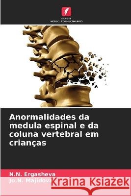 Anormalidades da medula espinal e da coluna vertebral em crianças N N Ergasheva, Jo N Majidova 9786205271278 Edicoes Nosso Conhecimento