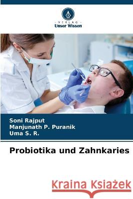 Probiotika und Zahnkaries Soni Rajput, Manjunath P Puranik, Uma S R 9786205278864 Verlag Unser Wissen