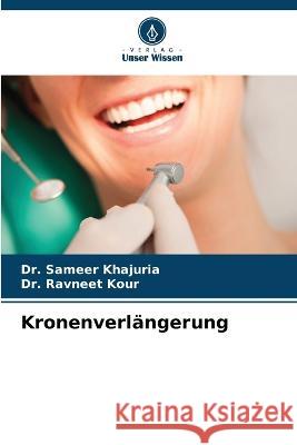 Kronenverlängerung Khajuria, Sameer 9786205280614