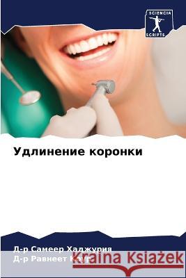 Удлинение коронки Хаджуl 9786205280669 Sciencia Scripts