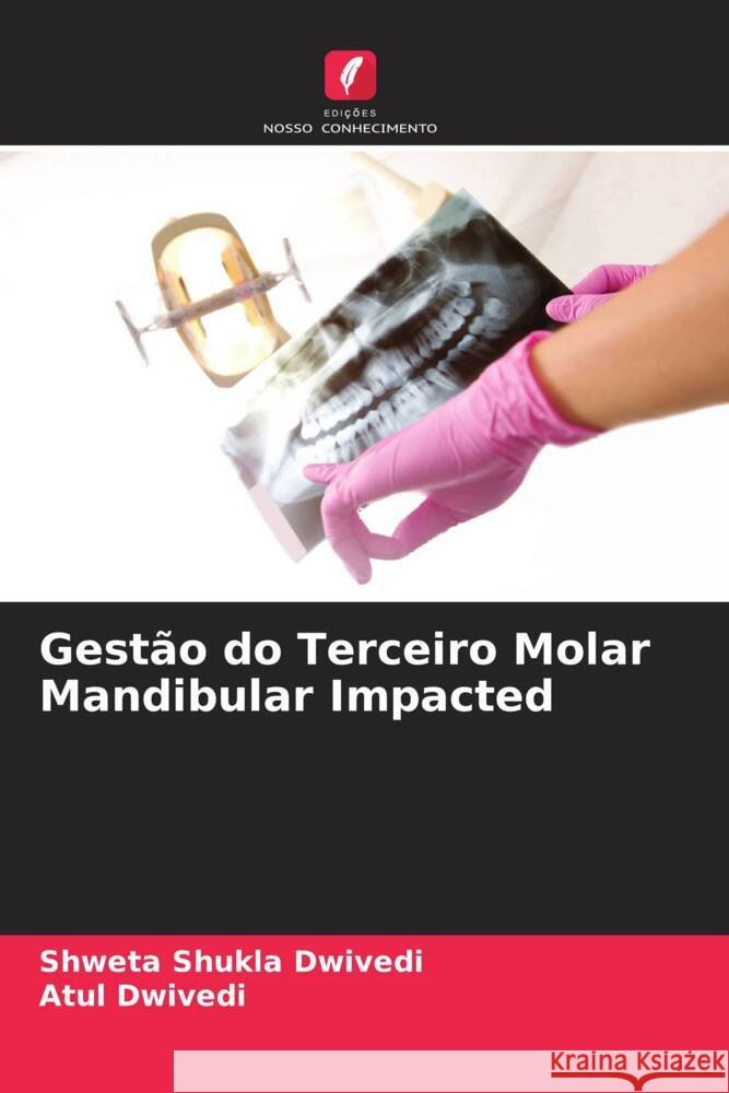 Gestão do Terceiro Molar Mandibular Impacted Shweta Shukla Dwivedi, Atul Dwivedi 9786205281574