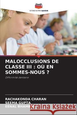 Malocclusions de Classe III: Où En Sommes-Nous ? Charan, Rachakonda 9786205287613 Editions Notre Savoir