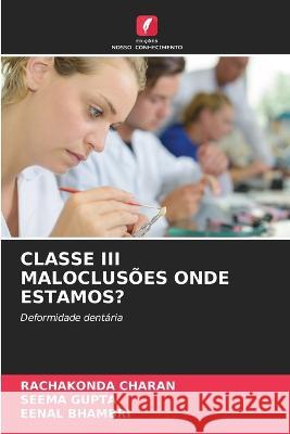 Classe III Maloclusões Onde Estamos? Charan, Rachakonda 9786205287644 Edicoes Nosso Conhecimento