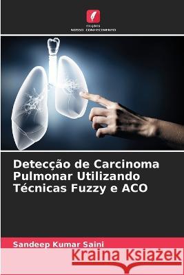 Detecção de Carcinoma Pulmonar Utilizando Técnicas Fuzzy e ACO Sandeep Kumar Saini 9786205291245