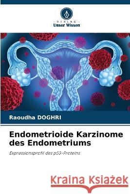 Endometrioide Karzinome des Endometriums Raoudha Doghri 9786205292433