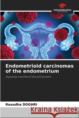 Endometrioid carcinomas of the endometrium Raoudha Doghri 9786205292440