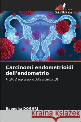 Carcinomi endometrioidi dell\'endometrio Raoudha Doghri 9786205292464