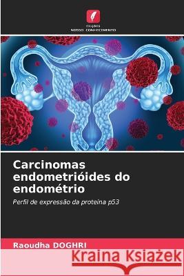 Carcinomas endometrióides do endométrio Doghri, Raoudha 9786205292488