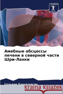 Амебные абсцессы печени Каннаm 9786205292907 Sciencia Scripts