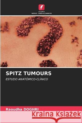 Spitz Tumours Raoudha Doghri 9786205293256