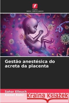 Gestão anestésica do acreta da placenta Sahar Elleuch, Kamel Kolsi 9786205295069 Edicoes Nosso Conhecimento
