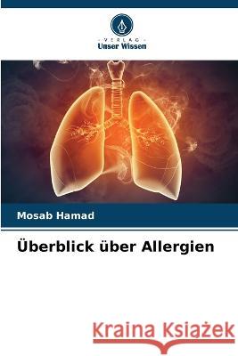 Überblick über Allergien Hamad, Mosab 9786205297315 Verlag Unser Wissen