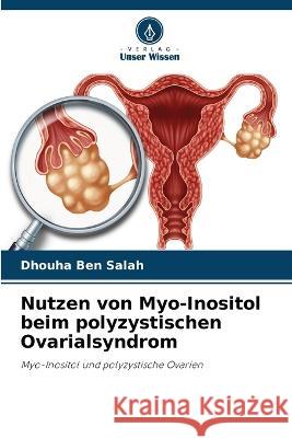 Nutzen von Myo-Inositol beim polyzystischen Ovarialsyndrom Dhouha Ben Salah   9786205300947 Verlag Unser Wissen