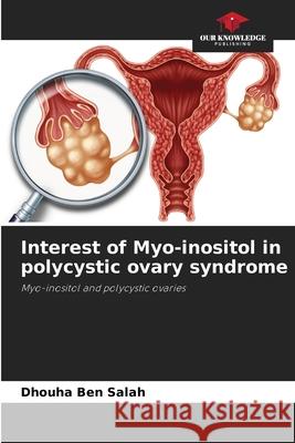 Interest of Myo-inositol in polycystic ovary syndrome Dhouha Ben Salah   9786205300954 Our Knowledge Publishing